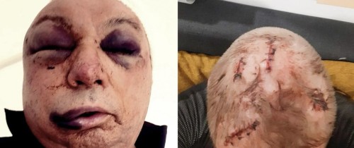 original_bloody_skull_antifa_german_cell.jpg